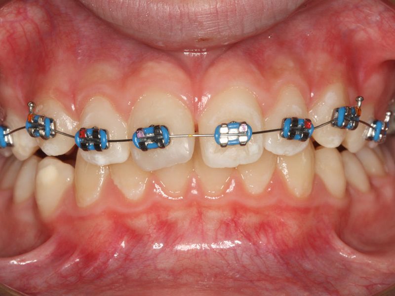 orthodontiki_efivon1