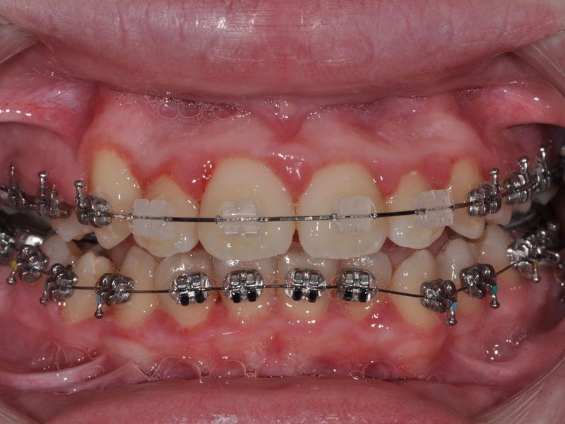 orthodontiki_efivon2