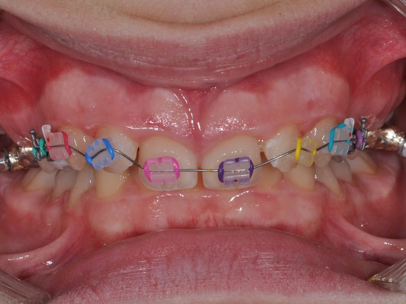 orthodontiki_kids1