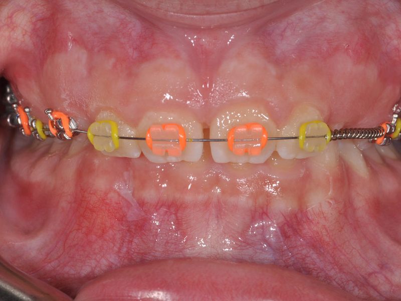 orthodontiki_kids2