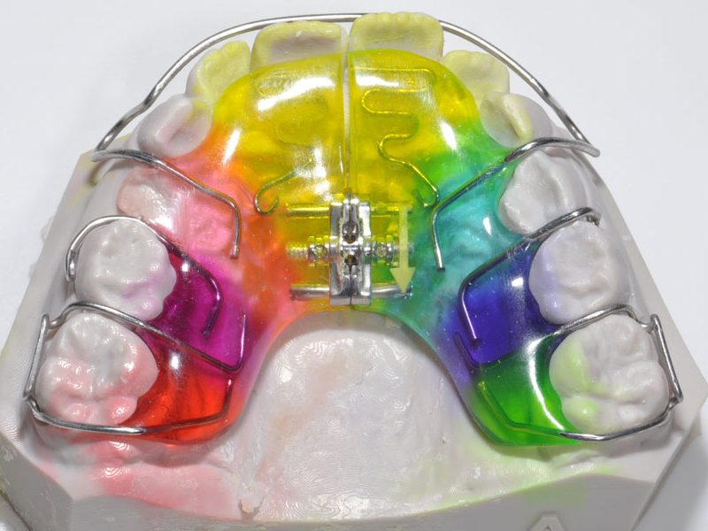 orthodontiki_maselaki